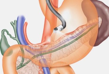 تأثیر موسیقی آرام روی بهبود دستگاه گوارش