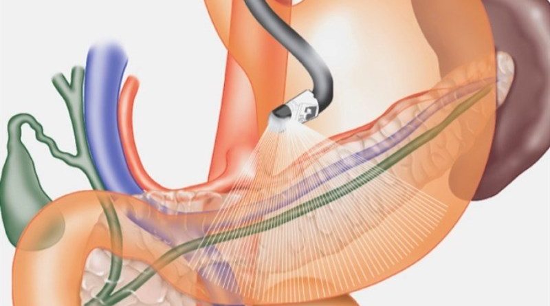 تأثیر موسیقی آرام روی بهبود دستگاه گوارش