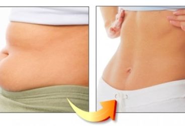 ۵ راز سوزاندن چربی‌های سرسخت شکم بدون نیاز به رژیم سخت